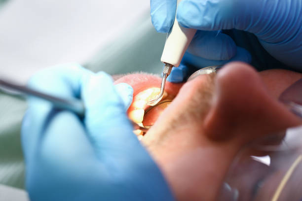 Tooth Infection Emergency Dentist in MN